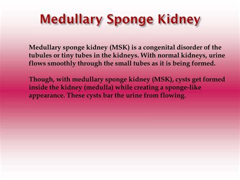 PPT - Medullary Sponge Kidney: Causes, Symptoms, Daignosis, Prevention and Treatment PowerPoint ...