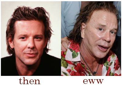 Mickey Rourke Plastic Surgery Before and After Photos - Star Plastic ...