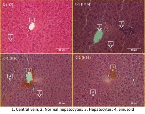 Gambar 7. Gambar mikroskopis dari struktur hati normal mencit kontrol... | Download Scientific ...