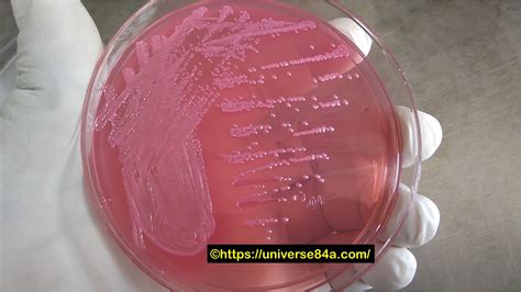 Escherichia coli: Introduction, Morphology, Pathogenicity, Lab