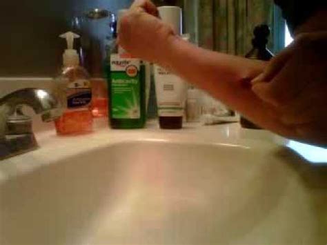 Popping huge boil - YouTube