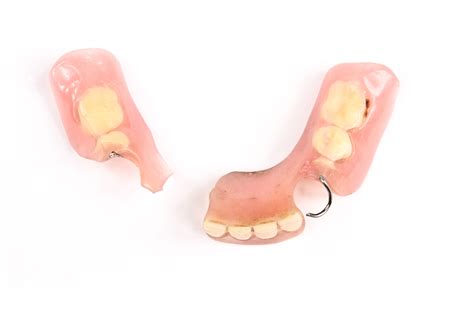 Signs Your Dentures Need to Be Replaced - Harrisburg, PA