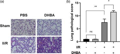 Activation of GPR81 aggravated intestinal ischemia/reperfusion injury ...