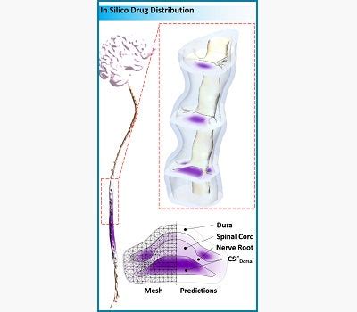 Intrathecal Drug Delivery to the CNS | Laboratory for Product and Process Design | University of ...