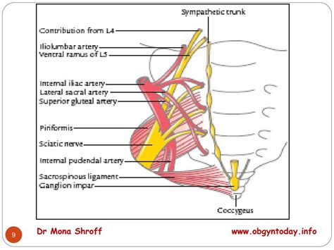 PPT - SACROSPINOUS FIXATION PowerPoint Presentation, free download - ID:533471