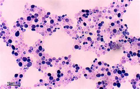 Fungal toxin triggers NET traps formed by white blood cells | News ...