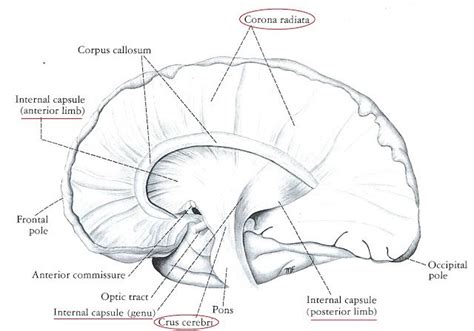 Internal capsule and corona radiata | Internal capsule, White matter, Corpus callosum