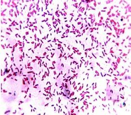 Isolated E. coli in Gram's straining (microscopic) showing Gram... | Download Scientific Diagram