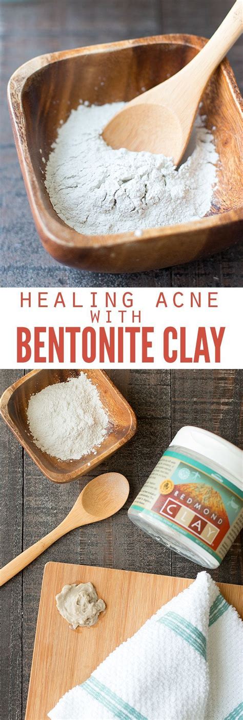 How to Heal Acne with Bentonite Clay | Bentonite clay, Natural skin ...