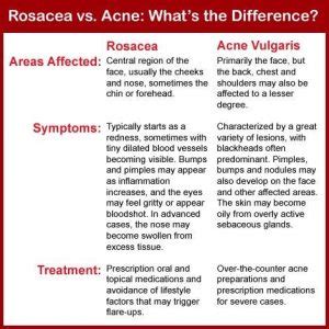 Lupus vs. rosacea, differences in symptoms, causes, and treatment