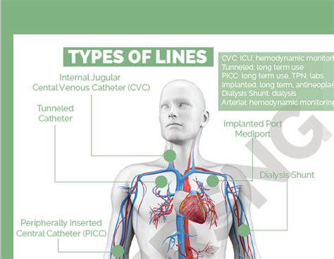 Central Venous Pressure, Central Venous Catheter, Central Line, Types Of Lines, Nursing School ...