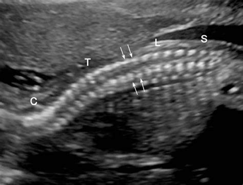 Fetal Imaging | Obgyn Key