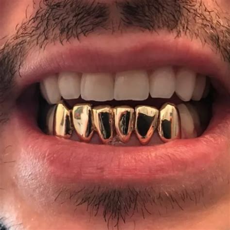 14k Gold Grillz – Grillz Pro