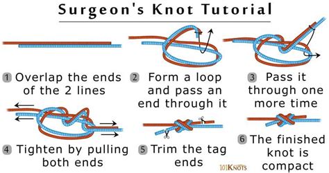 How To Tie A Square Suture Knot - Franklin Morrison's Coloring Pages