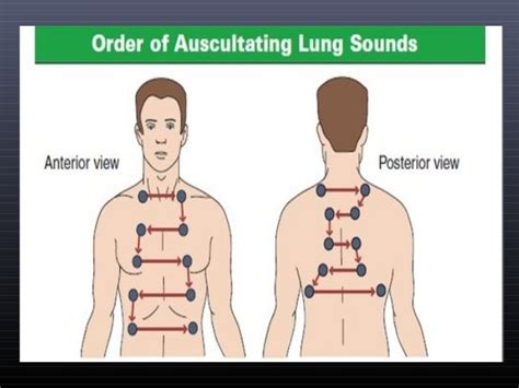 Auscultation of the lungs