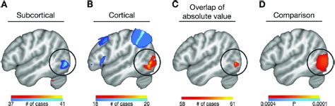 Connectivity to extrastriate visual cortex differs between cortical and... | Download Scientific ...