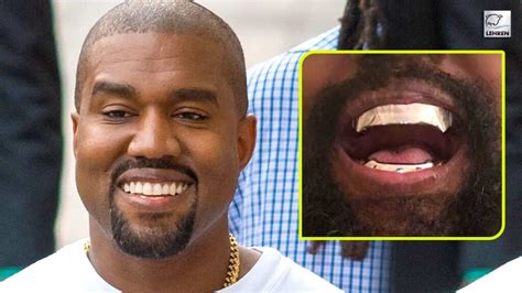 Kanye West Replaces His Teeth With Custom-Made Titanium Dentures