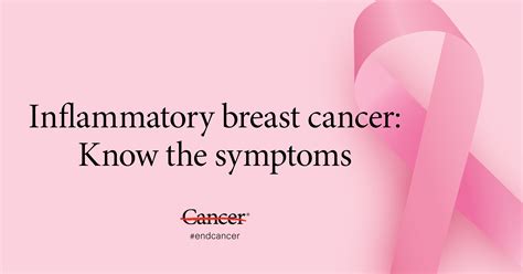 What Are The First Symptoms Of Inflammatory Breast Cancer : Inflammatory Breast Cancer Russian ...