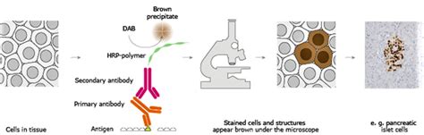 Immunohistochemistry, immunohistochemistry technique & clinical ...