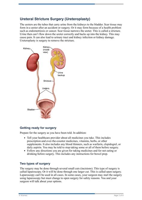 PDF - Ureteral Stricture Surgery (Ureteroplasty) - HealthClips Online