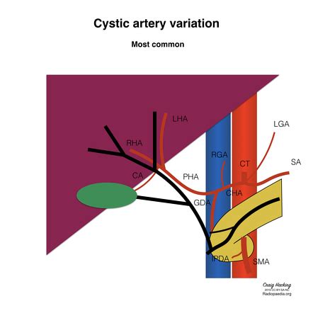 Common Hepatic Duct Anatomy