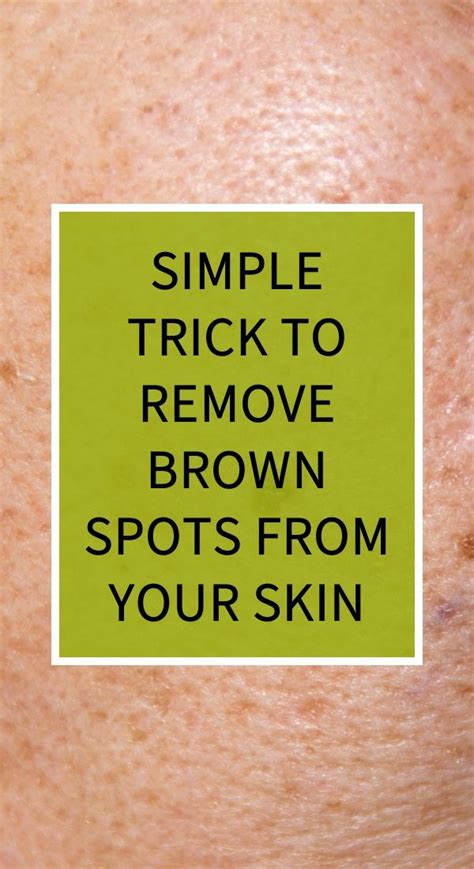 Simple Trick to Remove Brown Spots From Your Skin | Herbal cure, Natural teething remedies ...