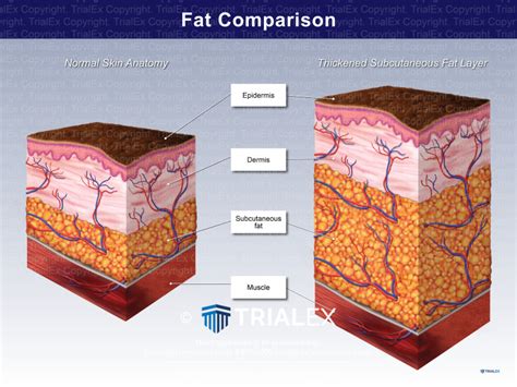 Fat Comparison - TrialQuest Inc.