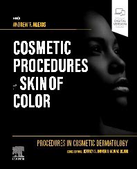 Procedures in Cosmetic Dermatology: Cosmetic Procedures in Skin of ...