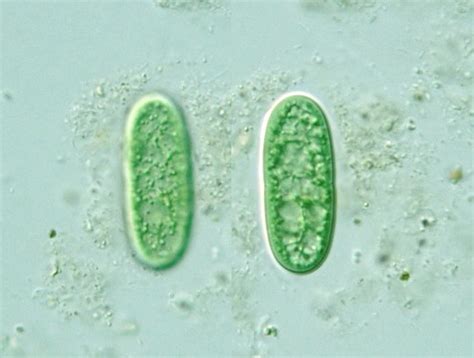 Prokaryote: Chroococcales: Cyanothece aeruginosus (Synechococcus aeruginosus)