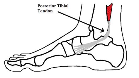 족근관절 염좌 (Ankle sprain) : 네이버 블로그