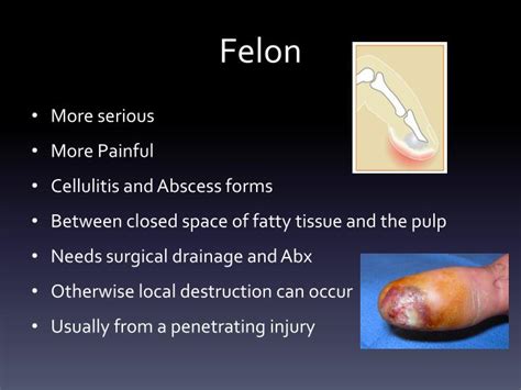 PPT - HAND INFECTIONS PowerPoint Presentation - ID:4624020