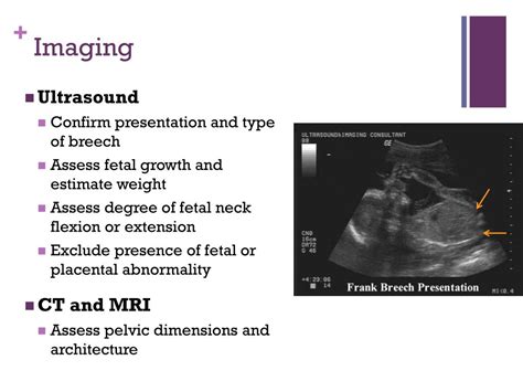 PPT - Breech Presentation PowerPoint Presentation, free download - ID:6051090