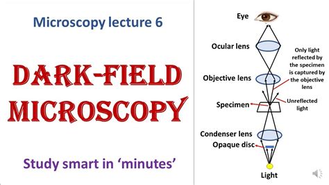 Dark-field microscope | working principle | Advantages, disadvantages ...