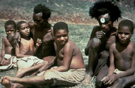 Four children with advanced kuru at Okapa, with two of their carers, 1957. | Download Scientific ...