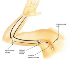 Which Area Of The Arm Drains To Epitrochlear Nodes Quizlet - Best Drain ...