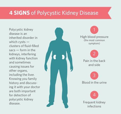 SIGNS OF POLYCYSTIC KIDNEY DISEASE YOU MUST WATCH OUT FOR! View 👉 http://bit.ly/2IM3hyW C ...