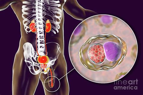 Chlamydia Infection #5 Photograph by Kateryna Kon/science Photo Library ...