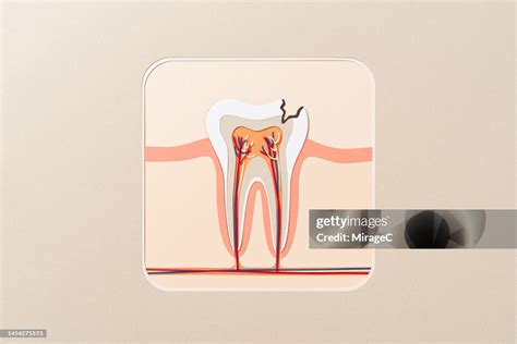 Tooth Decay Cross Section Anatomy Paper Cut Craft High-Res Stock Photo ...