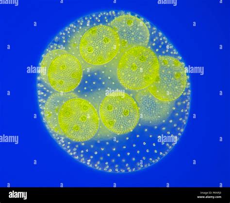 Blue green algae micrograph hi-res stock photography and images - Alamy