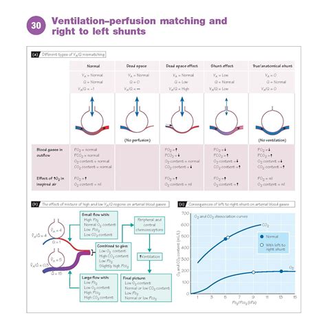 Ventilation Perfusion Matching And Right To Left Shunts - pediagenosis