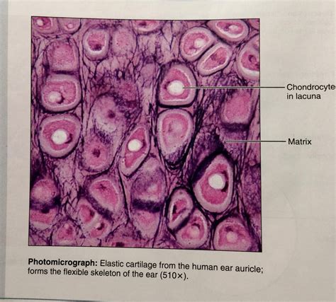 Elastic cartilage Diagram | Quizlet