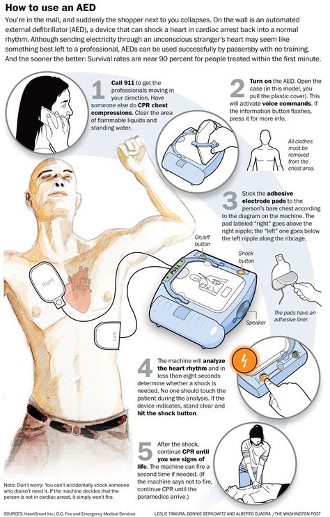 Automated External Defibrillator Pdf