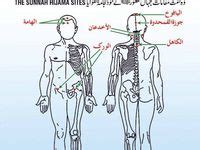 8 Hijama points ideas | hijama points, hijama, cupping points