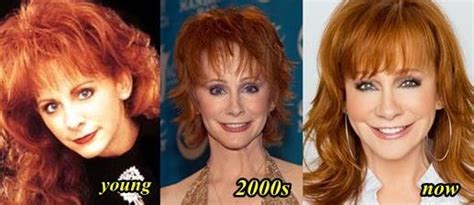 Reba McEntire Plastic Surgery Success