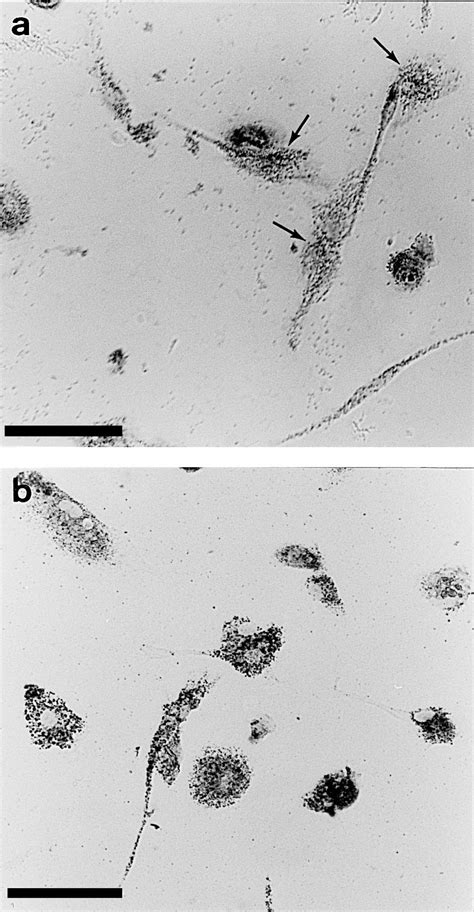 Human adult microglial cells cultures derived from a sample of Ž . the... | Download Scientific ...