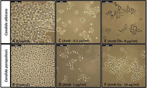 Candida Morphology