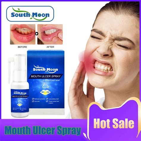 Mouth Ulcer Spray Relieve Periodontal Blister Antibacterial Bad Breath Treatment Gum Ache Relief ...