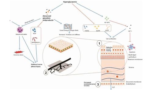 Pathophysiology of diabetic keratopathy (Shih KC, Lam KS-L, Tong L ...