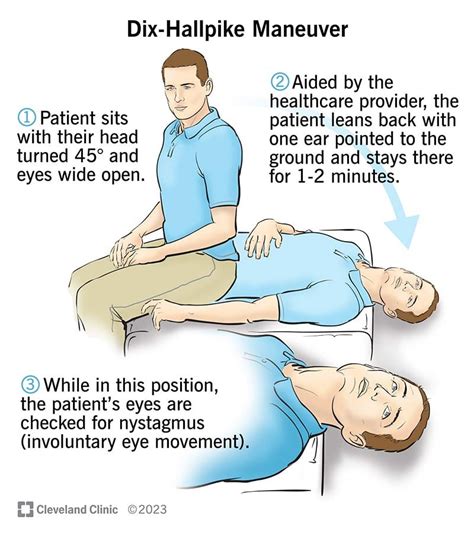 Dix-Hallpike Maneuver: Test, Purpose & Results