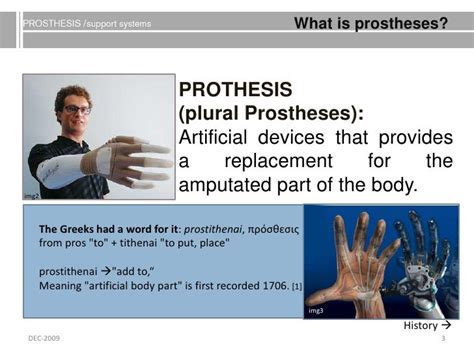 Prosthesis